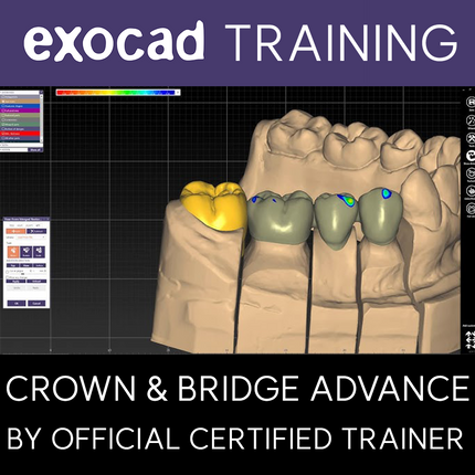 20250613-Exocad Training-Crown & Bridge Advance Considering Manufacturing Process