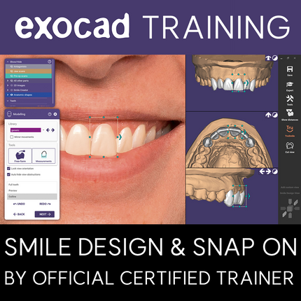 20250502-Exocad Training-Smile Design and Snap On